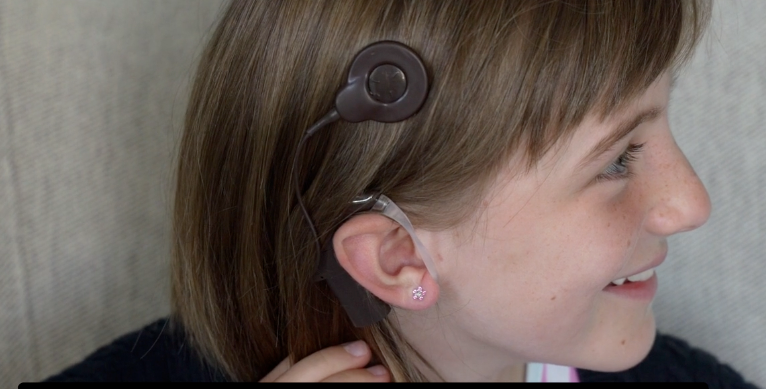Cochlear